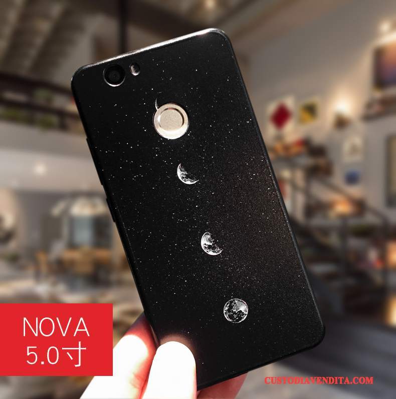 Custodia Huawei Nova Protezione Morbido Anti-caduta, Cover Huawei Nova Colore Tendenza Ornamenti Appesi